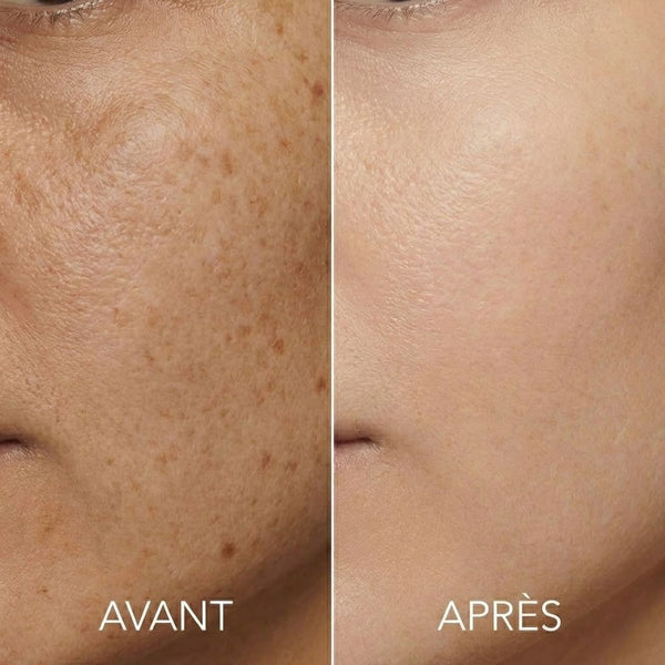 Sarah T. Avant Après Taches