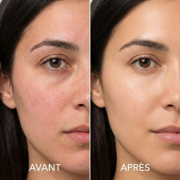 Emma P. Avant Après Apaisement