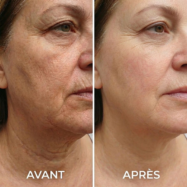 Isabelle G. Avant Après Régénération